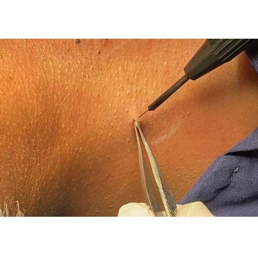 skin-aging