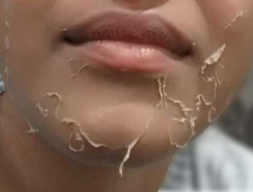skin-care